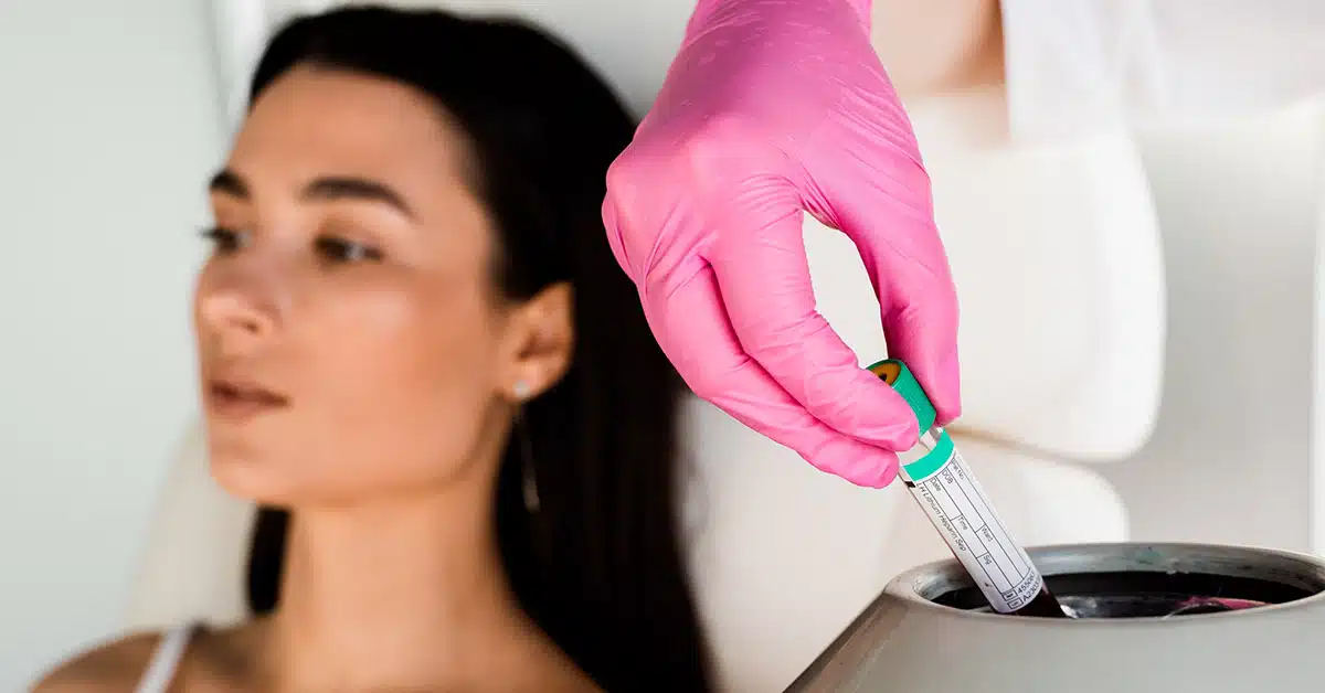 PRF y bioestimuladores de tejidos