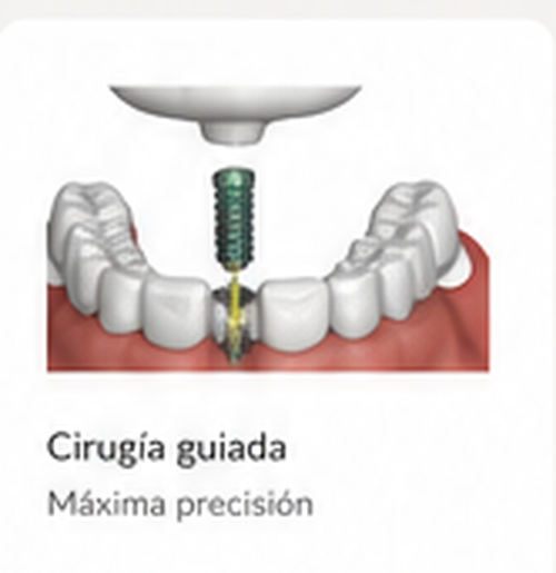 Cirugía guiada